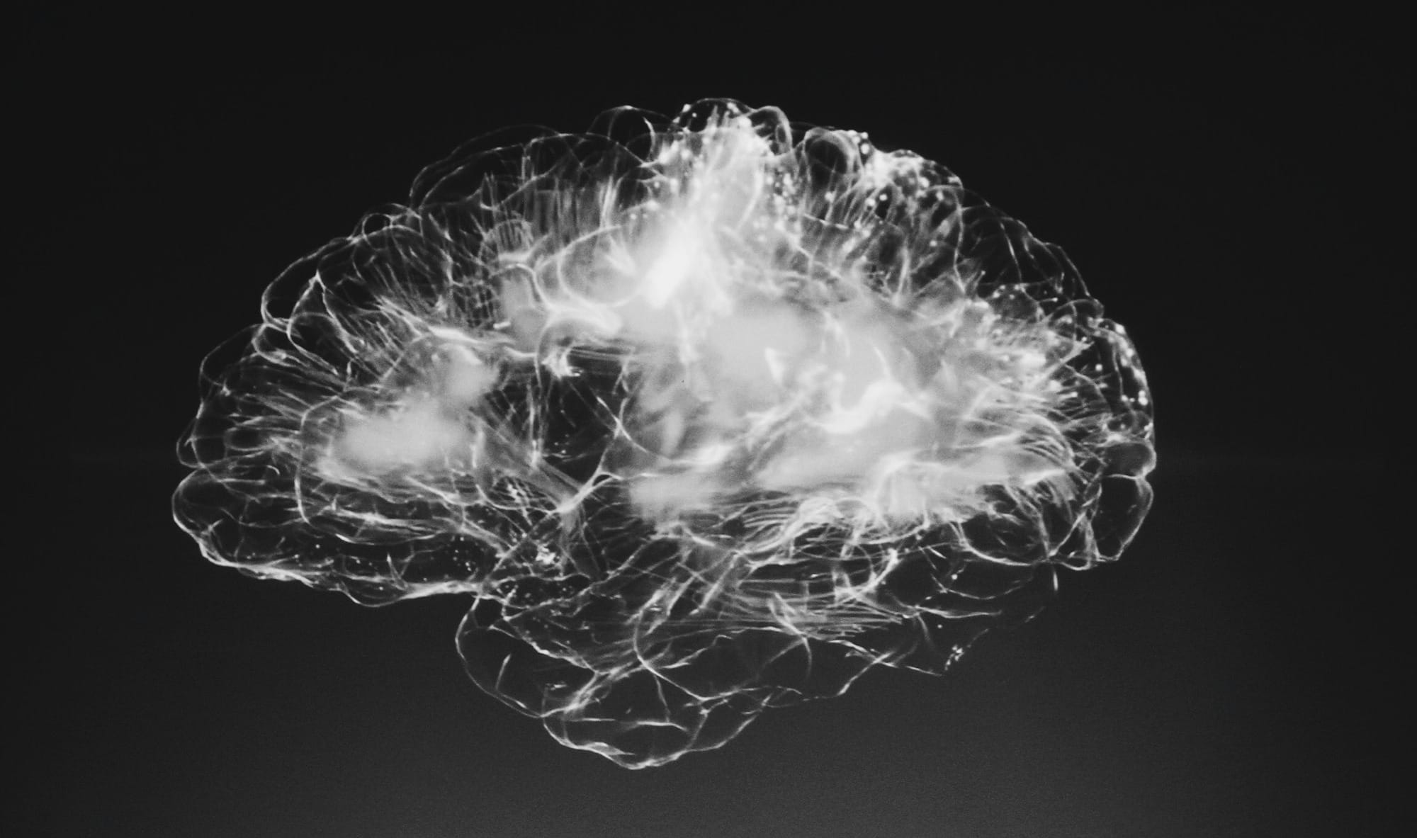 a black and white photo of a brain